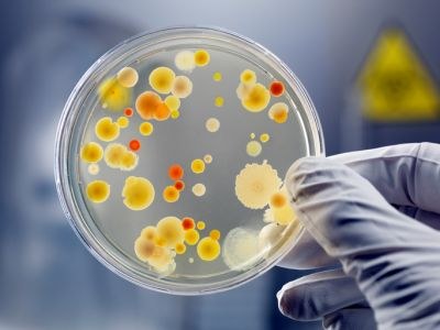 Nieuwe antilichamen ontdekt tegen ziekenhuisbacterie